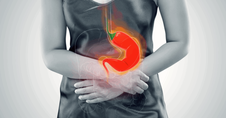 Acid Reflux